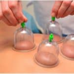 Myofascial cupping massage at Able Body in Lethbridge